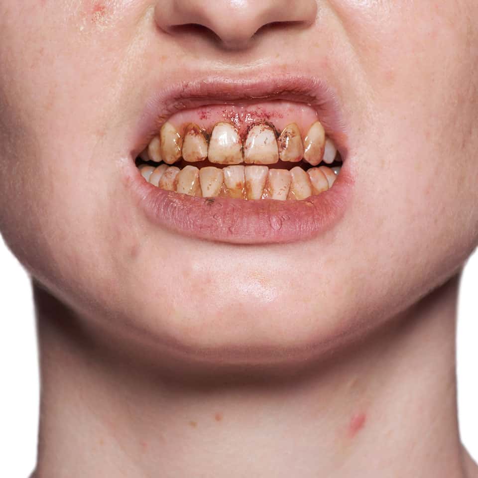 kryolan tooth enamel teeth makeup sfxzone tips