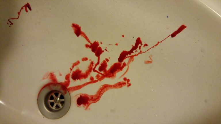 fake blood tips